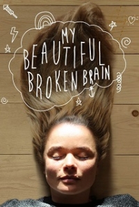 My Beautiful Broken Brain (2014)